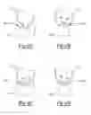 Fig. 03 - Use of optimized piston member for generating peak liquid pressure