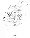 Fig. 13 - Method of using separator roll positioner in a removable media dam and separator roll speed to correct feed errors
