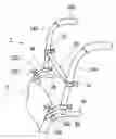 Fig. 01 - ATTACHMENT DEVICE AND METHOD OF USE THEREOF