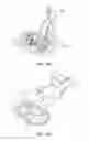 Fig. 04 - ATTACHMENT DEVICE AND METHOD OF USE THEREOF