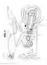 Fig. 02 - The heel buddy