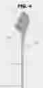 Fig. 05 - The heel buddy