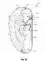 Fig. 06 - Airbag with active vent