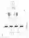 Fig. 08 - Method and apparatus for providing acknowledgement bundling