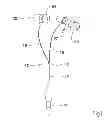 Fig. 02 - Ear canal ear bud sound system
