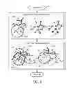Fig. 08 - Endoscopic registration of vessel tree images