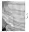 Fig. 30 - Blemish Removal