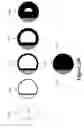 Fig. 47 - Blemish Removal