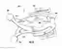 Fig. 07 - Clasp