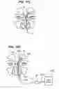 Fig. 09 - Methods and devices for facilitating visualization in a surgical environment