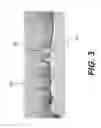 Fig. 04 - WEAR COMPONENT FOR COMPACTOR WHEEL