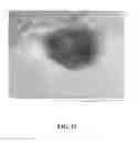 Fig. 16 - Solid silver-copper alloy having mainly a non-eutectic structure not containing a eutectic at room temperature