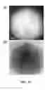 Fig. 23 - Solid silver-copper alloy having mainly a non-eutectic structure not containing a eutectic at room temperature