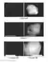 Fig. 05 - Imaging agent for detection of diseased cells