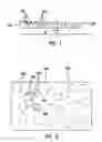 Fig. 02 - Medical device comprising boswellic acid