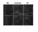 Fig. 07 - Combination therapy with interferon and andrographolides for Multiple Sclerosis