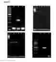 Fig. 07 - Microorganisms carrying a tumor antigen