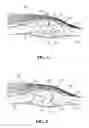 Fig. 02 - Human lubrication gel