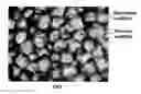 Fig. 01 - Double-structured tissue implant and a method for preparation and use thereof
