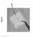 Fig. 02 - Double-structured tissue implant and a method for preparation and use thereof