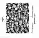 Fig. 06 - Double-structured tissue implant and a method for preparation and use thereof