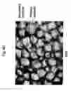 Fig. 07 - Double-structured tissue implant and a method for preparation and use thereof