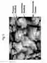 Fig. 08 - Double-structured tissue implant and a method for preparation and use thereof