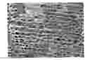 Fig. 01 - Biaxially oriented microporous membrane