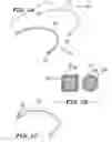 Fig. 02 - Orthodontic wire alignment system and method
