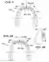 Fig. 08 - Orthodontic wire alignment system and method