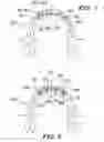 Fig. 09 - Orthodontic wire alignment system and method