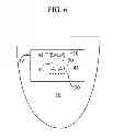 Fig. 07 - Orthodontic connector assembly and a method for treating teeth