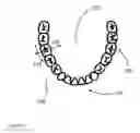 Fig. 07 - Base for an orthodontic appliance