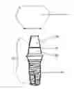Fig. 01 - Method of dental implant restoration