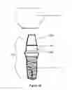 Fig. 04 - Method of dental implant restoration