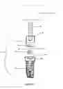 Fig. 09 - Method of dental implant restoration
