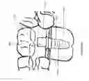 Fig. 12 - Method of dental implant restoration