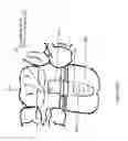 Fig. 13 - Method of dental implant restoration
