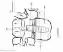 Fig. 14 - Method of dental implant restoration