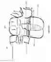 Fig. 15 - Method of dental implant restoration