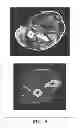 Fig. 08 - COMPOSITE TISSUE GRAFT AND MATERIALS AND METHODS FOR ITS PRODUCTION AND USE