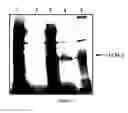 Fig. 02 - PHARMACEUTICAL COMPOSITIONS AND METHODS USEFUL FOR MODULATING ANGIOGENESIS, INHIBITING METASTASIS AND TUMOR FIBROSIS, AND ASSESSING THE MALIGNANCY OF COLON CANCER TUMORS