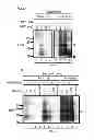 Fig. 02 - DETECTION OF INFECTIOUS PRION PROTEIN BY SEEDED CONVERSION OF RECOMBINANT PRION PROTEIN