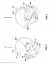 Fig. 03 - Methods and devices for adjusting sensitivity of proximity sensor
