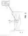 Fig. 06 - Golf club including an electronic module
