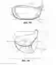 Fig. 03 - Golf club head