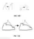 Fig. 22 - Golf club head