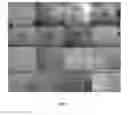 Fig. 02 - METHODS OF DIAGNOSING AND TREATING VASCULAR ASSOCIATED MACULOPATHY AND SYMPTOMS THEREOF