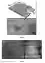 Fig. 07 - METHODS OF DIAGNOSING AND TREATING VASCULAR ASSOCIATED MACULOPATHY AND SYMPTOMS THEREOF