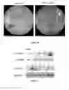 Fig. 28 - METHODS OF DIAGNOSING AND TREATING VASCULAR ASSOCIATED MACULOPATHY AND SYMPTOMS THEREOF